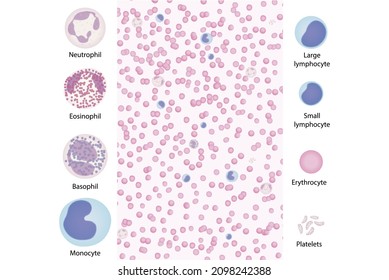 3,196 Basophil Images, Stock Photos & Vectors | Shutterstock