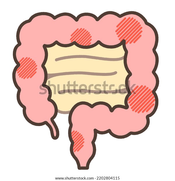 Illustration Crohns Disease Explaining Stock Illustration 2202804115 Shutterstock 9401