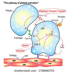 The illustration demonstrates the pathway of platelet activation and the mechanisms of antiplatelet agents preventing local thrombosis. it is the common cause of ischemic stroke and heart attack.