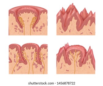 Illustration Of Dorsal Surface Of Tongue And Taste Buds