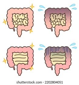 Illustration Healthy Unhealthy Intestines Explaining Stock Illustration ...