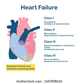 Illustration Of Heart Structure. The Classification Of Heart Failure And Describe The Symptoms Of Each Stage.