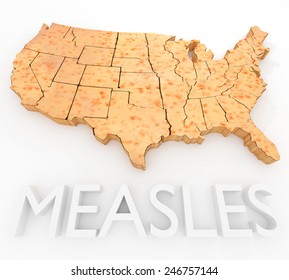 An Illustration Related To The Measles Virus Outbreak In The United States.