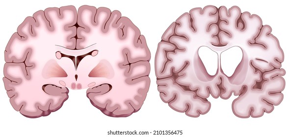 343 Basal cluster Images, Stock Photos & Vectors | Shutterstock