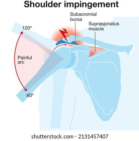 Illustration Showing Shoulder Anatomy. Rotator Cuff Muscles. Labeled Illustration. Blue Red