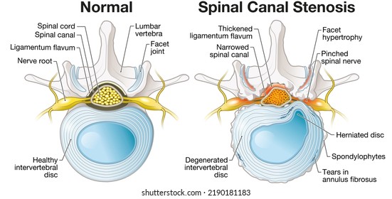 5,749 Spinal Structure Images, Stock Photos & Vectors | Shutterstock