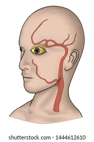 the illustration shown the vascular distribution supplying the brain and eyes. Both of them are sypplied by caroitd artery system. Ophthalmic artery occlusion cuased of visual loss may precedes stroke