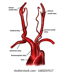 The Illustration Shows The Anatomy Of Cerebral Vascular Circulation. Aorta, Subclavian Artery, Carotid Artery, Vertebral Artery Were Demonstrated.