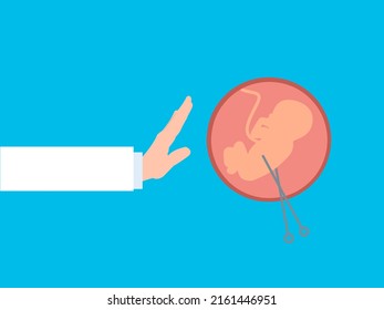 Illustration Of Stop Abortion Surgery