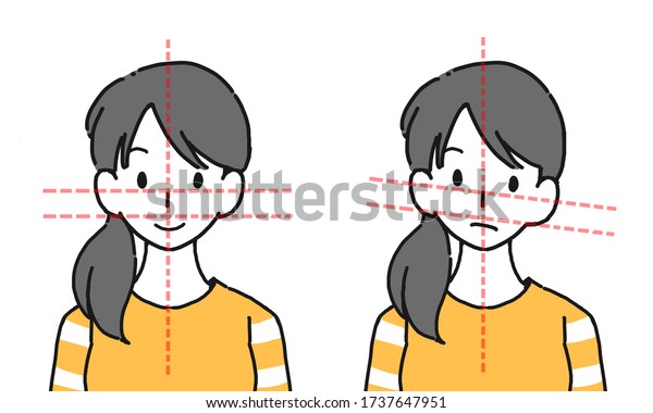 \
Illustration of a woman suffering from\
facial\
distortion