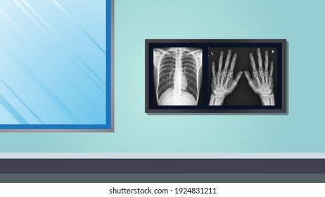 Illustration of an x-ray room with a computer irradiator. - Powered by Shutterstock