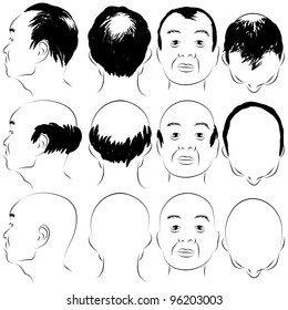 An image of an asian male pattern baldness set.