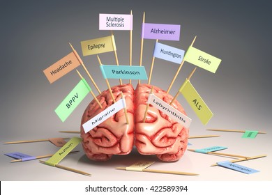 Image of a brain on the table with various nameplates of various diseases that can affect our brain. It's a 3D image with nameplates stuck by toothpick. Clipping path included.