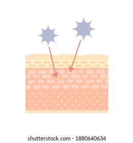 An Image Of The Structure Of The Skin With Reduced Barrier Function.