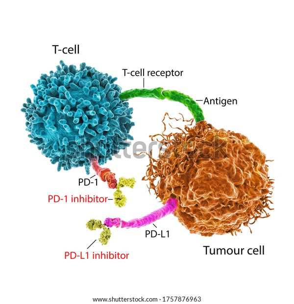 がん治療における免疫チェックポイント阻害剤 3dイラスト Pd 1受容体およびpd L1のインヒビターは 腫瘍細胞がpd 1に結合するのを防ぎ T細胞を活性なままにする のイラスト素材