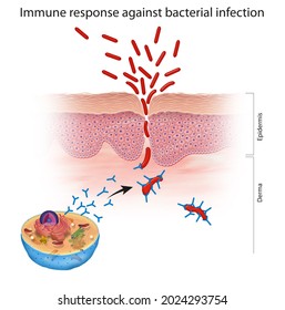 Immune response against bacterial infection