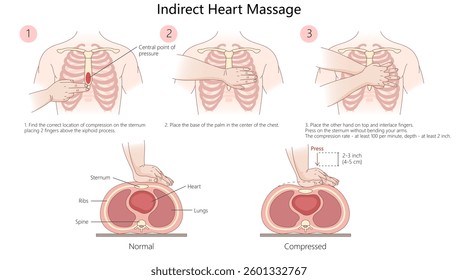 indirect heart massage (CPR), showing proper hand placement, compression depth, and technique for effective chest compressions diagram hand drawn raster illustration. Medical science educational