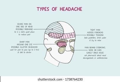 Types Headaches Hd Stock Images Shutterstock