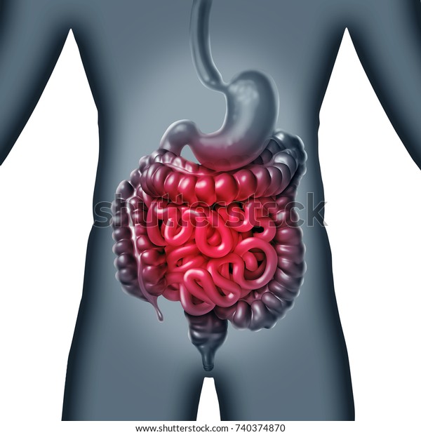 腸と腸の痛みと胃腸の消化の炎症は 3dイラストとしての消化不快感や便秘 感染として起こる のイラスト素材
