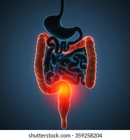 intestines disease illustration