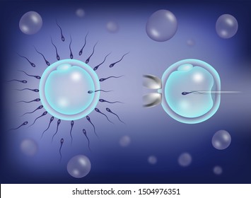 Intracytoplasmic Sperm Injection Icsi Part Ivf ilustrações stock Shutterstock