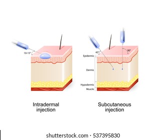 Subcutaneous Injection Images, Stock Photos & Vectors | Shutterstock