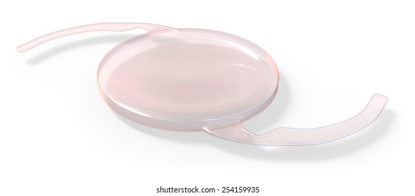 Intraocular Lens Implant Isolated On White