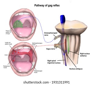 The Inversation Of Cranial Nerve Ninth And Tenth Involving Gag Reflex Mechanism