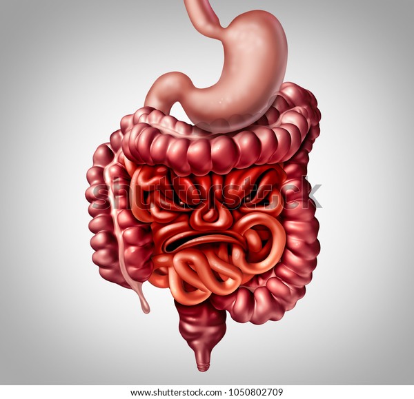 過敏性腸症候群の診断と腸や大腸の炎症の症状は 3dイラストエレメントを持つ怒りの顔の形をした腸のような形をしています のイラスト素材