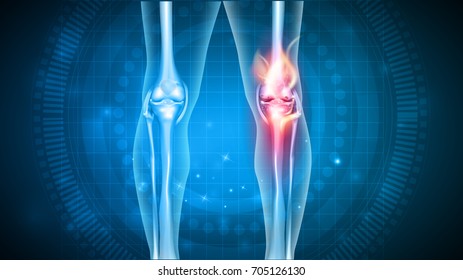 Joint problems bright abstract design, burning damaged knee 