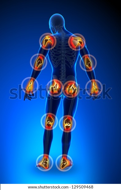 Joints Pain\
Full Figure - Arthritis Anatomy\
concept