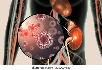 Kidney Disease Concept. Viral Infection. 3d Illustration