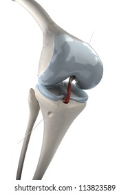 Knee arthroscopic anterior cruciate replacement stage 2