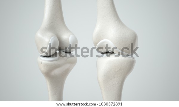 正常な軟骨と膝関節 前後 3dレンダリング のイラスト素材
