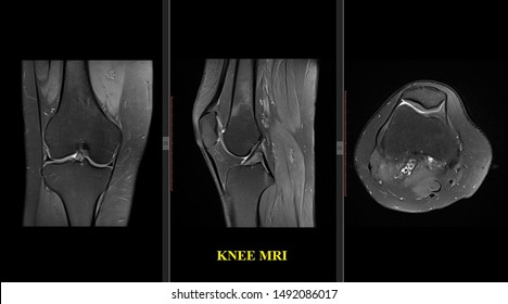 Knee Joint Mri Healthy Adult Magnetic Stock Illustration 1492086017 ...