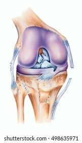 Knee - Ligament Tears - posterior cruciate ligament tear, medial meniscus ligament tear, tibial collateral ligament tear, partial fibular ligament tear, anterior cruciate ligament rupture.

