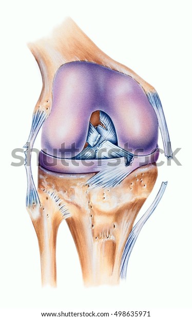 膝 靱帯涙 後十字靱帯断裂 内側半月靱帯断裂 脛骨側副靱帯裂 半腓靱帯裂 前十字靱帯断裂 のイラスト素材