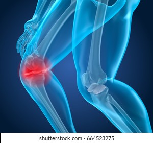 Knee Pain Attack, Man Suffering From Spinal Knee. 3D Illustration 