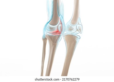 Knee Pain Cartilage, Bone And Muscles, Human Leg Anatomy, 3d Illustration