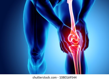 Knee painful - skeleton x-ray, 3D Illustration medical concept. - Powered by Shutterstock