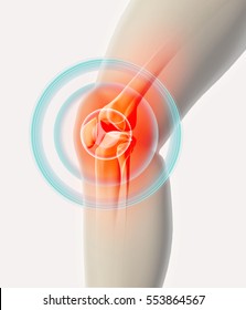 Knee painful - skeleton x-ray, 3D Illustration medical concept.
