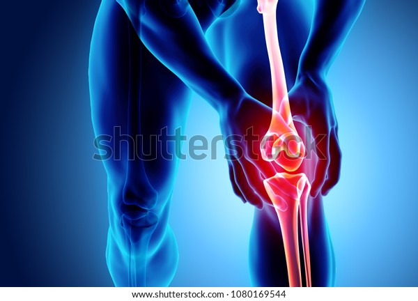 Knee painful - skeleton x-ray, 3D Illustration\
medical concept.