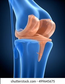 Knee and titanium hinge joint. X-ray view.  3D illustration 