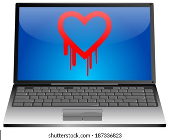 Laptop with Heartbleed bug