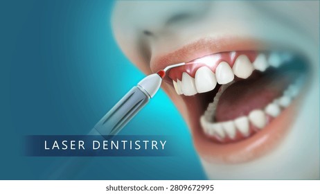 Laser Dentistry - A close view	