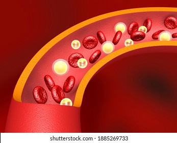 LDL cholesterol in arteries. 3d illustration	