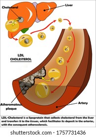 LDL CHOLESTEROL IS A LIPOPROTEIN