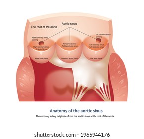 The Left Coronary Artery And The Right Coronary Artery Originate From The Left And Right Coronary Sinus Of The Aortic Root, Respectively.