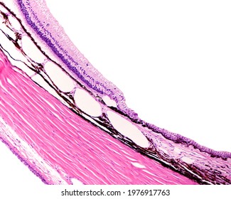 Limit between the retina (left) and ciliary body (right). The ten layers of retina are reduced to the two layers of the ciliary epithelium. Beneath are the pigmented vascularized choroid and sclera