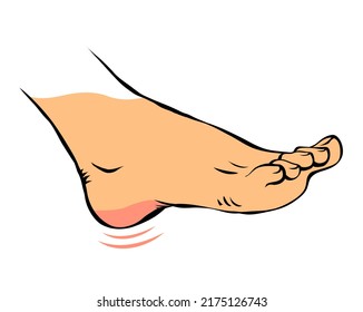 Line sketch female leg with problematic pain. Sore heel. Orthopedic disease plantar fasciitis. Beauty and health of feet. Illustration hand drawn isolated on white background - Powered by Shutterstock